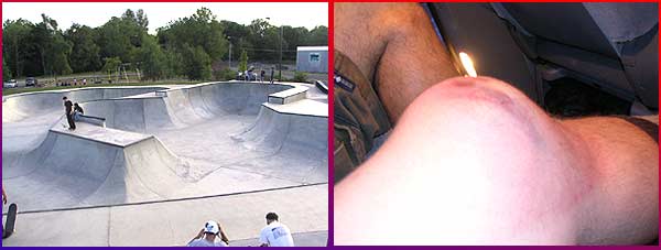 Aumsville Skatepark